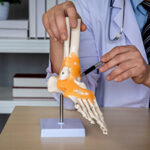 Ankle Replacement kapak